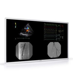 Monitor für Radiologie