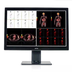 medizinisch Monitor 1