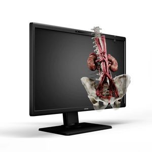 medizinisch Monitor