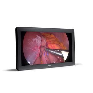 medizinisch Monitor