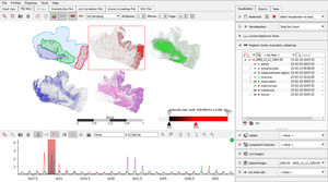 Analysesoftware / Visualisierung / Interpretation / für Massenspektrometrie