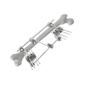 Fixateur externe / für Oberschenkelknochen
