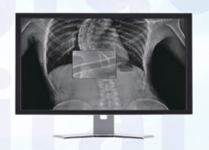 Software für Radiologie