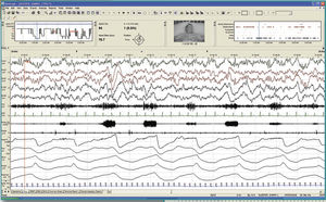 Software für EEG