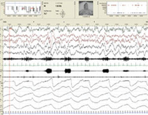 Management-Software / Analyse / Diagnose / Erfassung