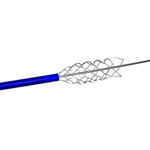 Titan-Stent 1