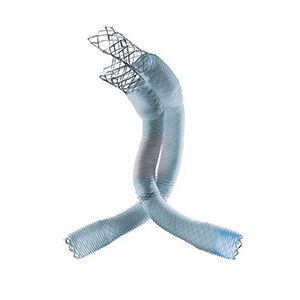 Stentgraft / Aorta abdominalis