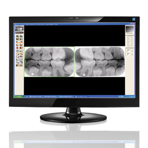 Software für dentale Bildgebung 1