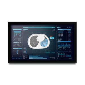 medizinisch Monitor 1