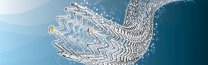 peripherer Stent 1
