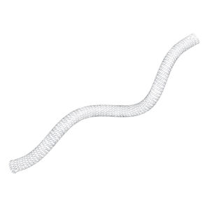 Arteria poplitea Stent