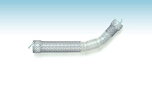 Speiseröhren-Stent 1