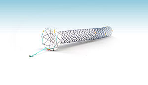 Gallenstent 1