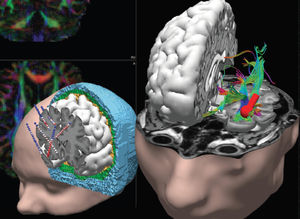 EEG-Software