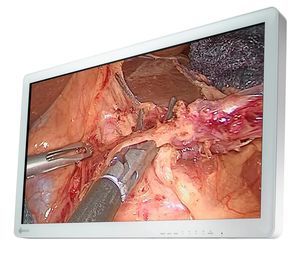 Monitor für OP-Bereich
