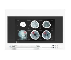 OP-Monitor 1