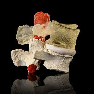 Anatomisches Modell / Lendenwirbel