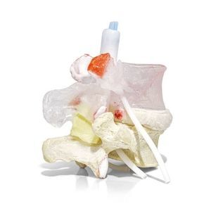 Anatomisches Modell / Bandscheibe