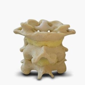 Anatomisches Modell / Wirbelsäule 1
