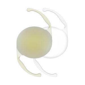 monofokale Intraokularlinse