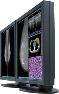 Mammographie-Monitor