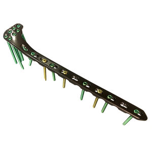 Kompressionsplatte für Tibia 1