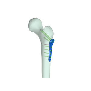 Anatomisches Modell / Patella