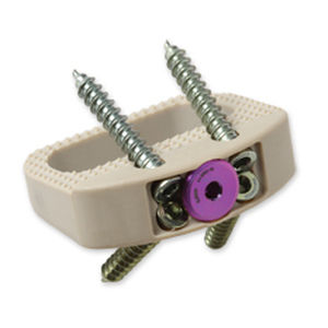 LWS-Zwischenwirbelimplantat
