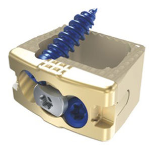 HWS-Zwischenwirbelimplantat