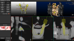 Software für roboterassistierte Chirurgie