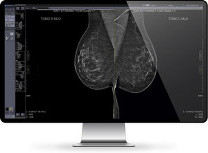 PACS für medizinische Bildgebung 1