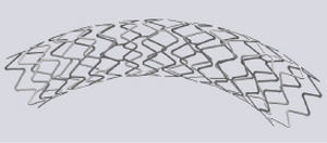Koronararterien-Stent 1