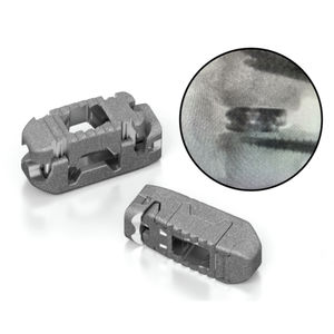 LWS-Zwischenwirbelimplantat