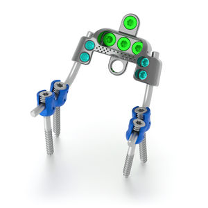 okzipito-zervikothorakales Stabilisierungssystem für Osteosynthese 1