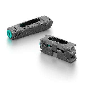 LWS-Zwischenwirbelimplantat 1
