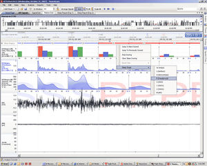 Software für neurophysiologische Stimulation