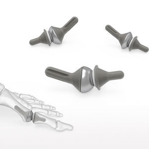 Implantat für Interphalangealgelenk des Fußes