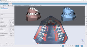 orthodontische Software