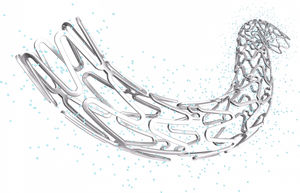 Koronararterien-Stent