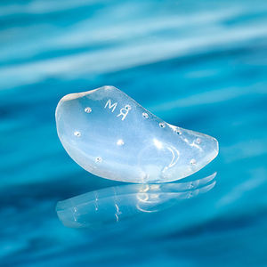 Jochbein Wangenknochen Implantat, ästhetisch 1