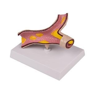 Anatomisches Modell / Arterie 1