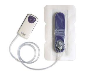Unterdruck-Wundtherapiesystem / mit Batterie