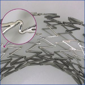 peripherer Stent