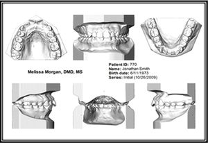 Software für Dentallabor