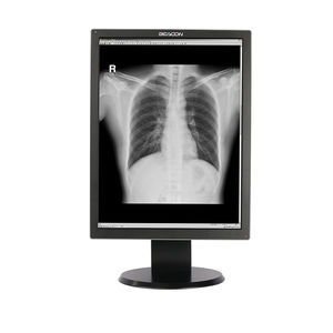 Diagnose-Monitor