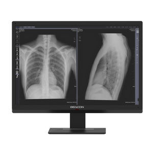 hochauflösender Monitor