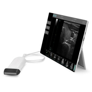 mobiles Ultraschallgerät / für Ultraschalldiagnostik Anästhesie und Intensivmedizin / Schwarz-Weiss / Nadelführung