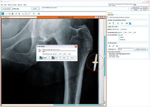 Software für Hüftchirurgie