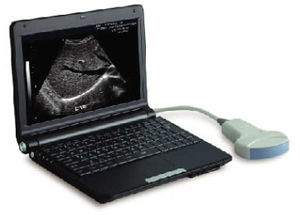 tragbares Ultraschallgerät