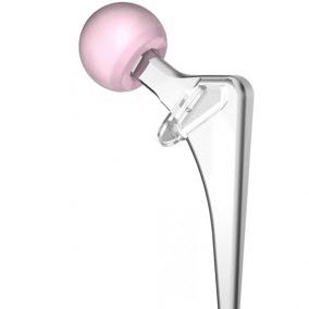 minimalinvasive Hüftschaftprothese / zementiert